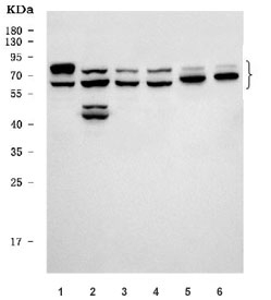 Western blot testing of 1) human HEL, 2) human A431, 3) human HaCaT, 4) human MCF7, 5) rat brain and 6) mouse brain tissue lysate with NOS1AP antibody. Predicted molecular weight ~56 kDa but ca be observed at ~70 kDa (NOS1AP-L) and 95-100 kDa (NOS1APc).