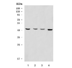 Western blot testing of 1) human ThP-1, 2) rat brain, 3) mouse brain and 4) mouse Neuro-2a cell lysate with OLIG2 antibody. Expected molecular weight: 32-38 kDa.