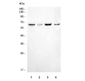Western blot testing of 1) human HepG2, 2) human U-2 OS, 3) human 293T and 4) mouse thymus tissue lysate with RNF8 antibody. Predicted molecular weight ~56 kDa but may be observed at larger sizes due to ubiquitination.~