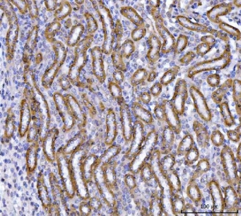 IHC staining of FFPE mouse kidney tissue with SLC22A7 antibody. HIER: boil tissue sections in pH8 EDTA for 20 min and allow to cool before testing.