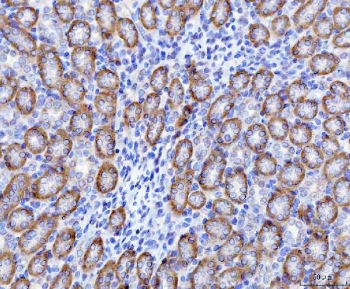IHC staining of FFPE rat kidney tissue with SLC22A7 antibody. HIER: boil tissue sections in pH8 EDTA for 20 min and allow to cool before testing.