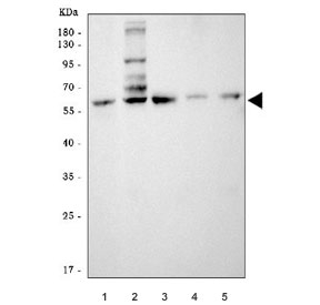 Western blot testing of 1) human HCCT, 2) rat liver, 3) rat kidney, 4) mouse liver and 5) mouse kidney tissue lysate with SLC22A7 antibody. Predicted molecular weight ~60 kDa.