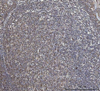 IHC staining of FFPE human tonsil tissue with TOMM20 antibody. HIER: boil tissue sections in pH8 EDTA for 20 min and allow to cool before testing.