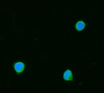 Immunofluorescent staining of FFPE human SiHa cells with TOMM20 antibody (green) and DAPI nuclear stain (blue). HIER: steam section in pH6 citrate buffer for 20 min.