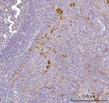 IHC staining of FFPE human tonsil tissue with Alkyl-DHAP synthase antibody. HIER: boil tissue sections in pH8 EDTA for 20 min and allow to cool before testing.
