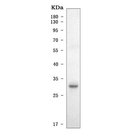 Western blot testing of human Daudi cell lysate with CD74 antibody. Expected molecular weight: 33-43 kDa.