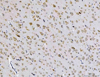 IHC staining of FFPE rat brain tissue with EIF3A antibody. HIER: boil tissue sections in pH8 EDTA for 20 min and allow to cool before testing.