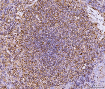 IHC staining of FFPE human spleen tissue with CD135 antibody. HIER: boil tissue sections in pH8 EDTA for 20 min and allow to cool before testing.~