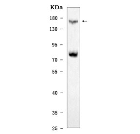 Western blot testing of human HCCP cell lysate with CD135 antibody. Expected molecular weight: 113-160