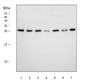 Western blot testing of human 1) A549, 2) 293T, 3) MCF7, 4) PC-3, 5) SH-SY5Y, 6) T-47D, 7) K562 cell lysate with MRPS18B antibody. Predicted molecular weight ~29 kDa.