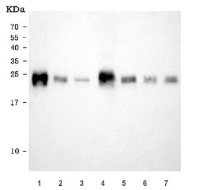 Western blot testing of 1) rat heart, 2) rat liver, 3) rat skeletal muscle, 4) mouse heart, 5) mouse liver, 6) mouse skeletal muscle and 7) mouse C2C12 cell lysate with NDUFS8 antibody. Expected molecular weight ~23 kDa.