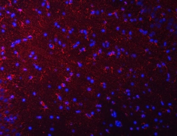 Immunofluorescent staining of FFPE rat brain tissue with Septin 2 antibody (red) and DAPI nuclear stain (blue). HIER: steam section in pH8 EDTA buffer for 20 min.