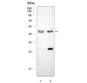 Western blot testing of 1) rat brain and 2) mouse brain tissue lysate with SEPT4 antibody. Predicted molecular weight ~53 kDa.