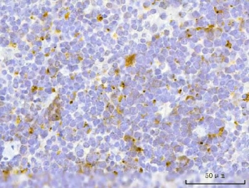 IHC staining of FFPE mouse spleen tissue with Transcription factor EB antibody. HIER: boil tissue sections in pH8 EDTA for 20 min and allow to cool before testing.