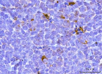 IHC staining of FFPE mouse spleen tissue with Transcription factor EB antibody. HIER: boil tissue sections in pH8 EDTA for 20 min and allow to cool before testing.