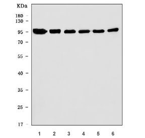Western blot testing of 1) human Jurkat, 2) human placenta, 3) rat brain, 4) rat liver, 5) mouse brain and 6) mouse liver tissue lysate with CANX antibody. Predicted molecular weight ~68 kDa but routinely observed at ~90 kDa.