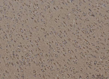 IHC staining of FFPE rat brain tissue with CANX antibody. HIER: boil tissue sections in pH8 EDTA for 20 min and allow to cool before testing.