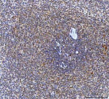 IHC staining of FFPE human spleen tissue with CAD Protein antibody. HIER: boil tissue sections in pH8 EDTA for 20 min and allow to cool before testing.