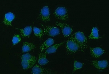 Immunofluorescent staining of FFPE human MCF7 cells with CAD Protein antibody (green) and DAPI nuclear stain (blue). HIER: steam section in pH6 citrate buffer for 20 min.