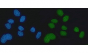 Immunofluorescent staining of FFPE human MCF7 cells with EXO1 antibody (green) and DAPI nuclear stain (blue). HIER: steam section in pH6 citrate buffer for 20 min.~
