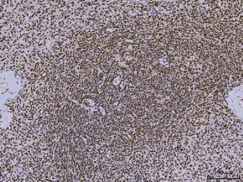 IHC staining of FFPE human spleen tissue with PC4 antibody. HIER: boil tissue sections in pH8 EDTA for 20 min and allow to cool before testing.