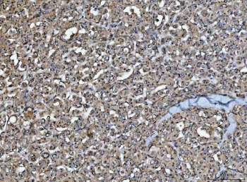 IHC staining of FFPE human testicular cancer tissue with HMG CoA Reductase antibody. HIER: boil tissue sections in pH8 EDTA for 20 min and allow to cool before testing.