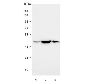 Western blot testing of human 1) U-87 MG, 2) HeLa and 3) A431 cell lysate with Glycogen synthase kinase-3 beta antibody. Predicted molecular weight ~46 kDa.