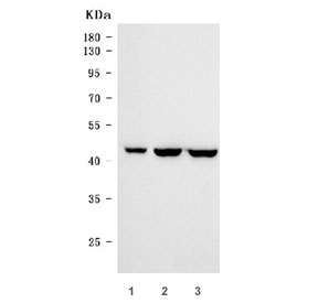 Western blot testing of human 1) SW620, 2) Caco-2 and 3) DLD1 cell lysate with CDX2 antibody. Predicted molecular weight: 33-40 kDa.