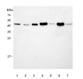 Western blot testing of 1) human HeLa, 2) human K562, 3) human 293T, 4) rat brain, 5) rat C6, 6) mouse brain and 7) mouse NIH 3T3 cell lysate with PANX1 antibody. Predicted molecular weight ~48 kDa.