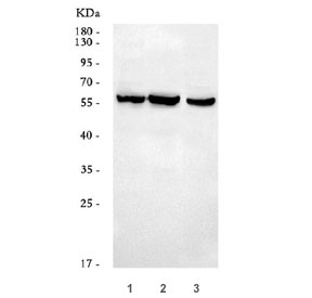 Western blot testing of 1) human MCF7, 2) human HeLa and 3) mouse brain tissue lysate with DUP antibody. Predicted molecular weight ~60 kDa.