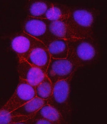 Immunofluorescent staining of FFPE human MCF7 cells with JUP antibody (red) and DAPI nuclear stain (blue). HIER: steam section in pH6 citrate buffer for 20 min.