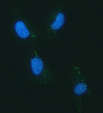Immunofluorescent staining of FFPE human U-87 MG cells with YKL-40 antibody (green) and DAPI nuclear stain (blue). HIER: steam section in pH6 citrate buffer for 20 min.~
