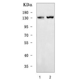 Western blot testing of human 1) MCF7 and 2) HeLa cell lysate with TYK2 antibo