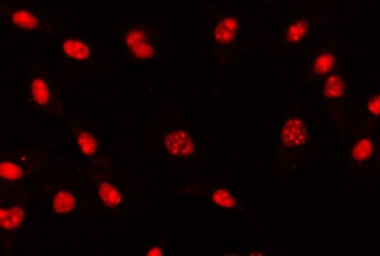 Immunofluorescent staining of FFPE human U-87 MG cells with TCF-8 antibody. HIER: steam section in pH6 citrate buffer for 20 min.