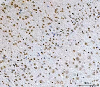IHC staining of FFPE mouse brain tissue with TCF-8 antibody. HIER: boil tissue sections in pH8 EDTA for 20 min and allow to cool before testing.