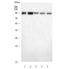 Western blot testing of 1) human SiHa, 2) human HeLa, 3) human HEL, 4) rat brain and 5) mouse brain tissue lysate with ADAR2 antibody. Expected molecular weight: 80-90 kDa.
