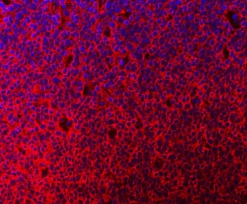 Immunofluorescent staining of FFPE human tonsil tissue with C-1-tetrahydrofolate synthase antibody (red) and DAPI nuclear stain (blue). HIER: steam section in pH8 EDTA buffer for 20 min.