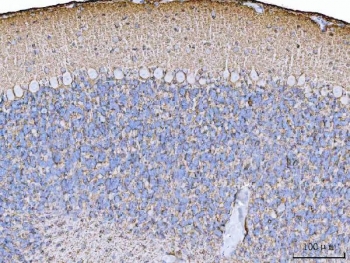 IHC staining of FFPE rat cerebellum tissue with EAAT1 antibody. HIER: boil tissue sections in pH8 EDTA for 20 min and allow to cool before testing.