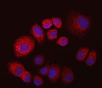Immunofluorescent staining of FFPE human T-47D cells with Inosine-5'-monophosphate dehydrogenase 2 antibody (red) and DAPI nuclear stain (blue). HIER: steam section in pH6 citrate buffer for 20 min.