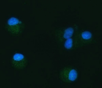Immunofluorescent staining of FFPE human A549 cells with TOMM40 antibody (green) and DAPI nuclear stain (blue). HIER: steam section in pH6 citrate buffer for 20 min.