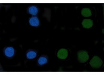 Immunofluorescent staining of FFPE human SiHa cells with CENPF antibody (green) and DAPI nuclear stain (blue). HIER: steam section in pH6 citrate buffer for 20 min.