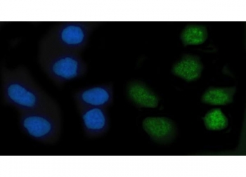 Immunofluorescent staining of FFPE human SiHa cells with KLF10 antibody (green) and DAPI nuclear stain (blue). HIER: steam section in pH6 citrate buffer for 20 min.~