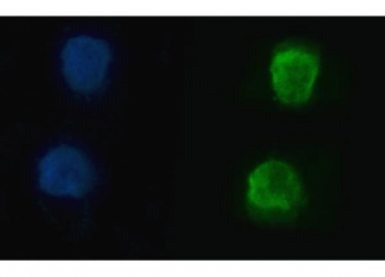 Immunofluorescent staining of FFPE human SiHa cells with hnRNP U antibody (green) and DAPI nuclear stain (blue). HIER: steam section in pH6 citrate buffer for 20 min.