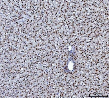 IHC staining of FFPE rat liver tissue with HNRPL antibody. HIER: boil tissue sections in pH8 EDTA for 20 min and allow to cool before testing.