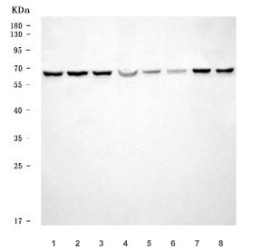 Western blot testing of 1) human Jurkat, 2) human MCF7, 3) human PC-3, 4) human U-87 MG, 5) rat liver, 6) mouse liver, 7) mouse RAW264.7 and 8) mouse NIH 3T3 cell lysate with HNRPL antibody. Predicted molecular weight ~64 kDa.