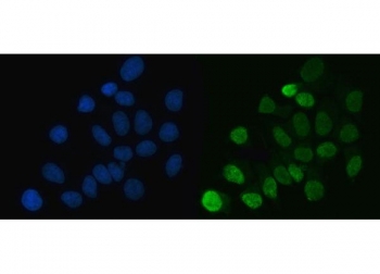 Immunofluorescent staining of FFPE human MCF7 cells with HNRPL antibody (green) and DAPI nuclear stain (blue). HIER: steam section in pH6 citrate buffer for 20 min.