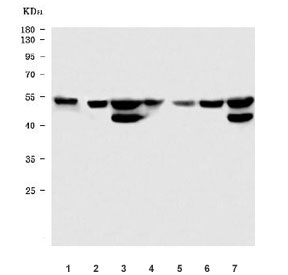 Western blot testing of 1) rat stomach, 2) rat testis, 3) rat brain, 4) mouse stomach, 5) mouse small intestine, 6) mouse testis and 7) mouse brain tissue lysate with STK24 antibody. Predicted molecular weight ~49 kDa.