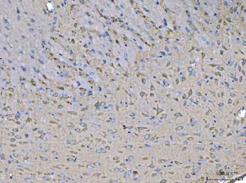 IHC staining of FFPE rat brain tissue with STK24 antibody. HIER: boil tissue sections in pH8 EDTA for 20 min and allow to cool before testing.