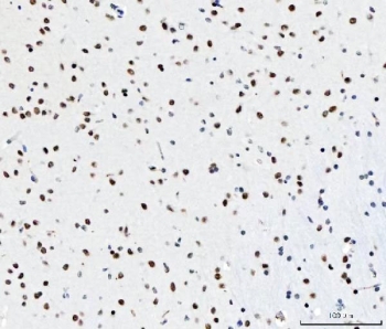 IHC staining of FFPE mouse brain tissue with CFIm68 antibody. HIER: boil tissue sections in pH8 EDTA for 20 min and allow to cool before testing.