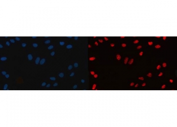Immunofluorescent staining of FFPE human U-2 OS cells with CFIm68 antibody (red) and DAPI nuclear stain (blue). HIER: steam section in pH6 citrate buffer for 20 min.